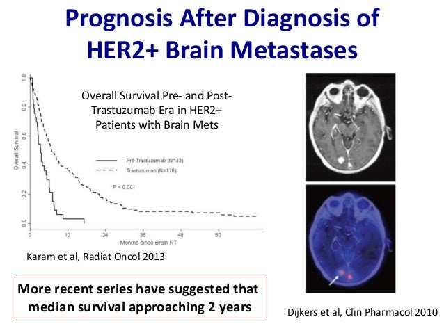 brain metastisis from breast cancer Brain metastisis from breast cancer